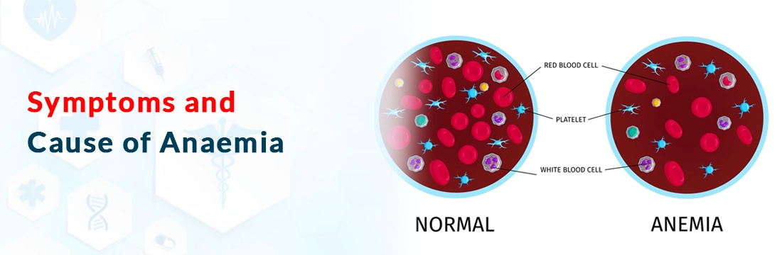 Symptoms and Cause of Anaemia